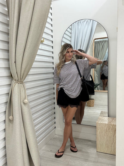 The Eden Set - Black and White Stripe